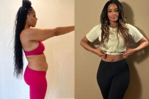 Vanessa Simmons Explains Why She Decided to Get Liposuction